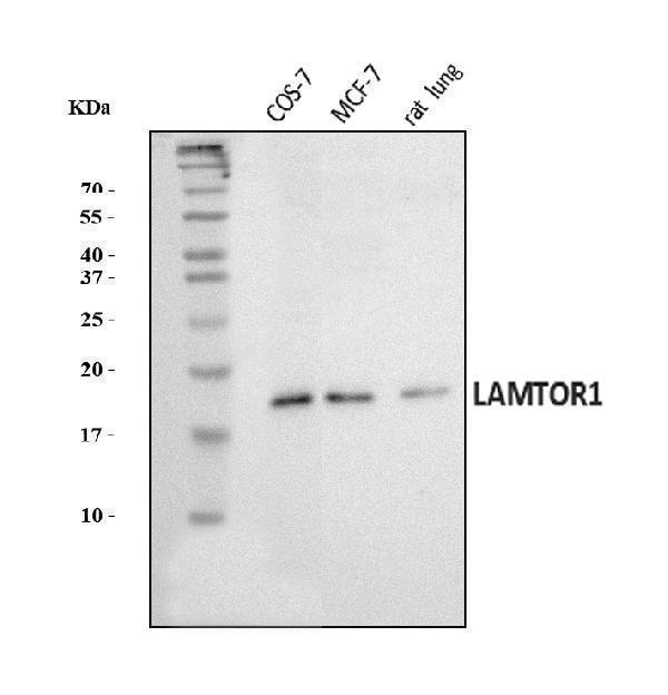  Western blot analysis of LAMTOR1 using anti-LAMTOR1 antibody (A06290-1)