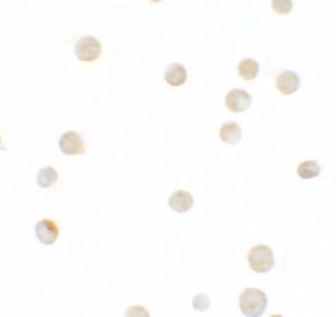 Immunocytochemistry of ZNF521 in HeLa cells with ZNF521 antibody at 2