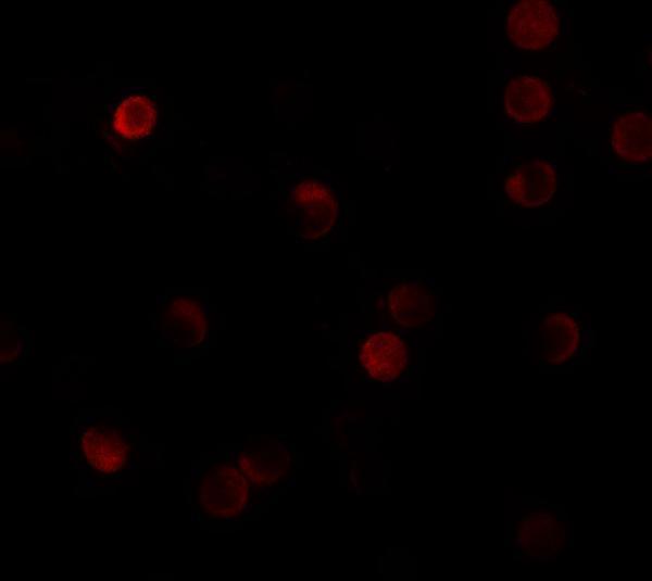 Immunofluorescence of ZNF521 in HeLa cells with ZNF521 antibody at 20 μg/mL
