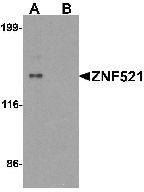 Western blot analysis of ZNF521 in HeLa cell lysate with ZNF521 antibody at 1 μg/ml in (A) the absence and (B) the presence of blocking peptide
