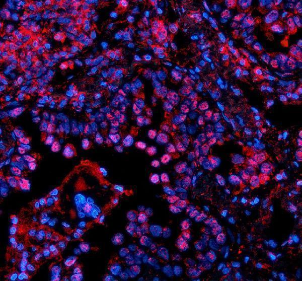 a06293 1 psmd1 primary antibodies if testing 1