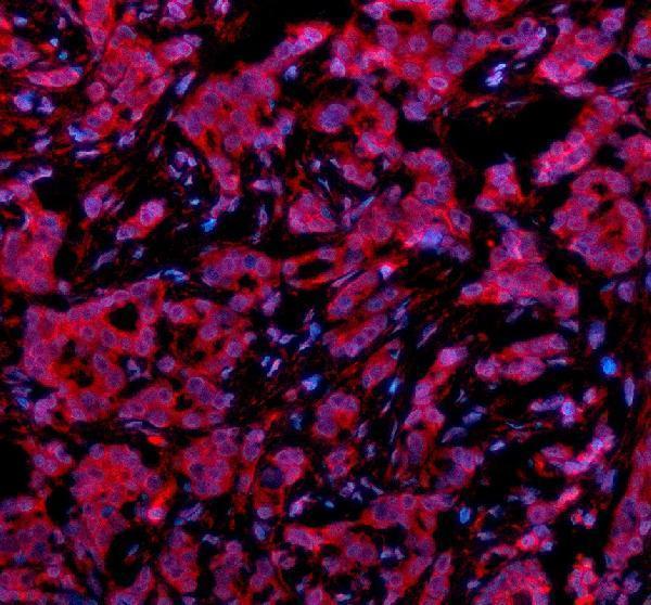 a06293 1 psmd1 primary antibodies if testing 2