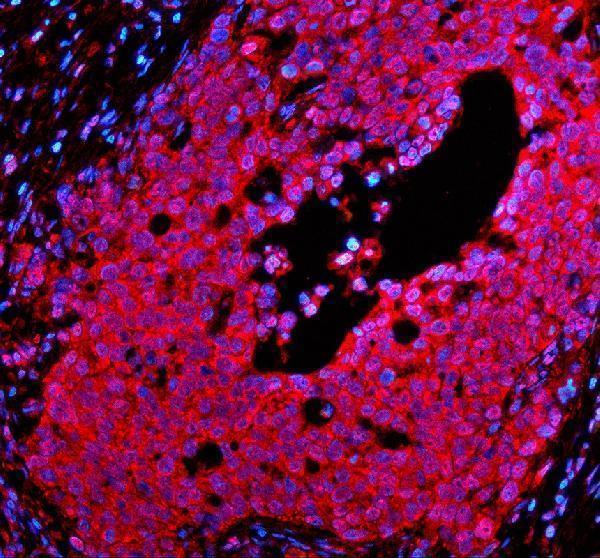 a06293 1 psmd1 primary antibodies if testing 4