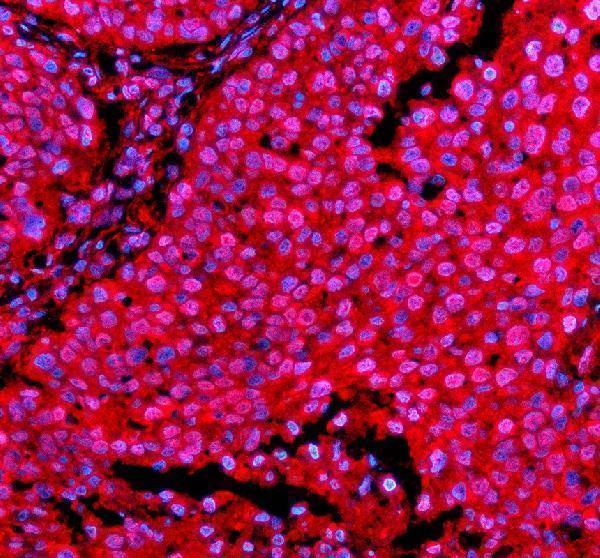 a06293 1 psmd1 primary antibodies if testing 5
