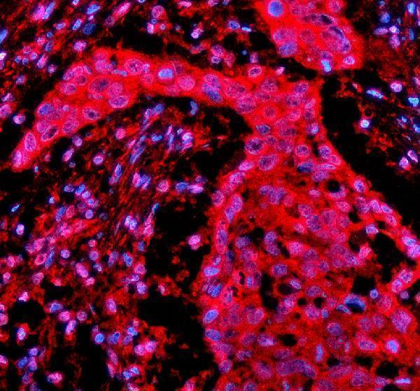 a06293 1 psmd1 primary antibodies if testing 6