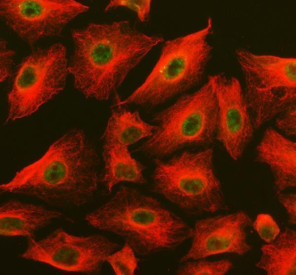 a06293 1 psmd1 primary antibodies if testing 7