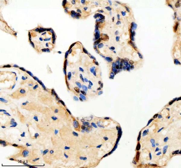IHC analysis of PSMD1 using anti-PSMD1 antibody (A06293-1)