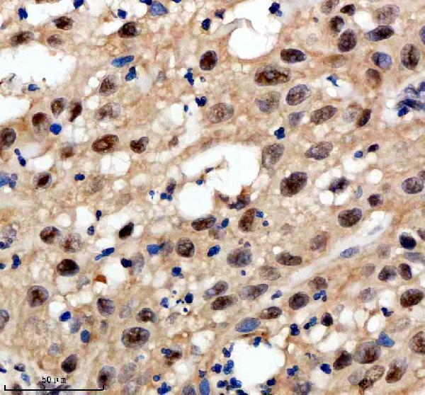 IHC analysis of PSMD1 using anti-PSMD1 antibody (A06293-1)