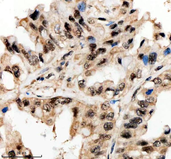 a06293 1 psmd1 primary antibodies ihc testing 3