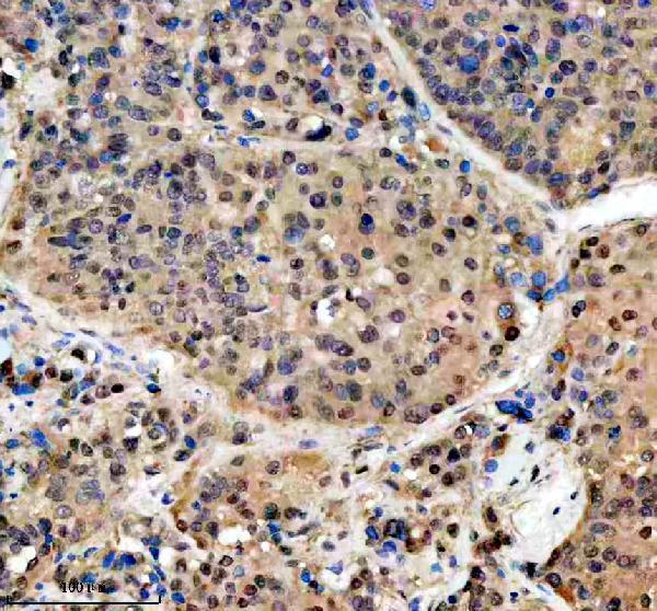 a06293 1 psmd1 primary antibodies ihc testing 4