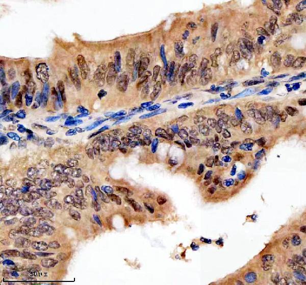 a06293 1 psmd1 primary antibodies ihc testing 5