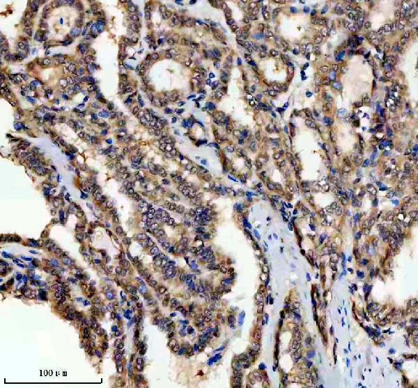 a06293 1 psmd1 primary antibodies ihc testing 6