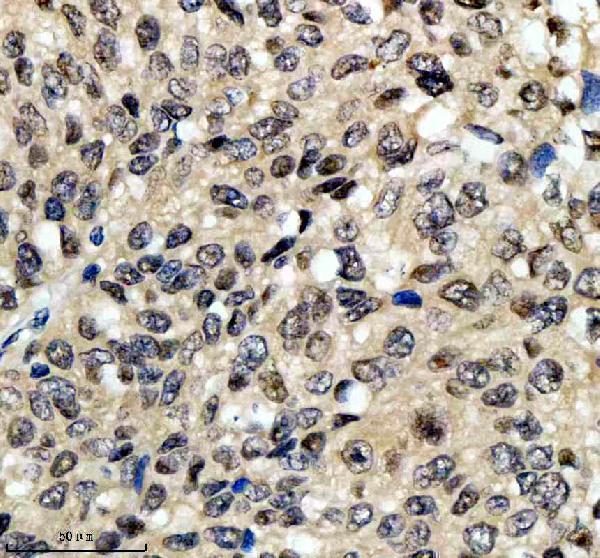 a06293 1 psmd1 primary antibodies ihc testing 7