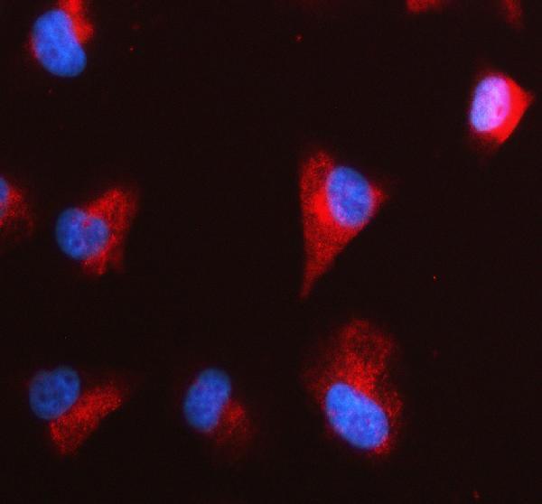 a06295 2 gpm6a primary antibodies if testing 1