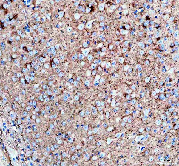 a06295 2 gpm6a primary antibodies ihc testing 1