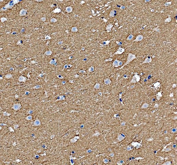 a06295 2 gpm6a primary antibodies ihc testing 3