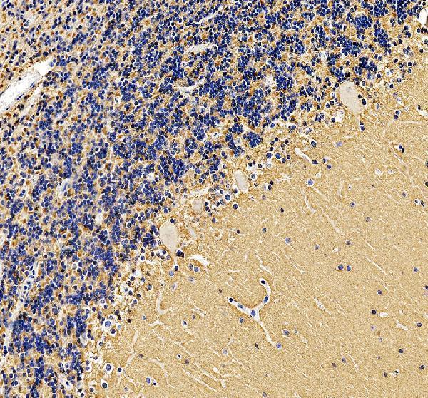 a06295 2 gpm6a primary antibodies ihc testing 4