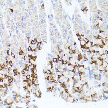 a06295 gpm6a primary antiboties ihc testing 2