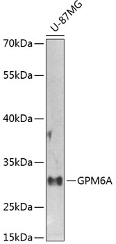 a06295 gpm6a primary antiboties wb testing 1
