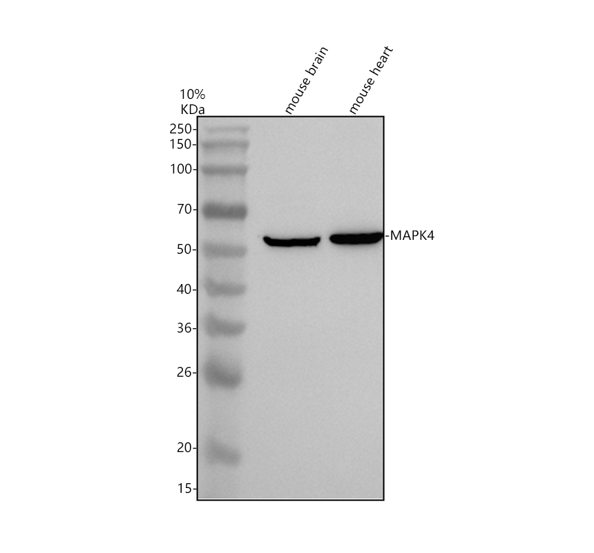 Western blot analysis of MAPK4 using anti-MAPK4 antibody (A06298-2)