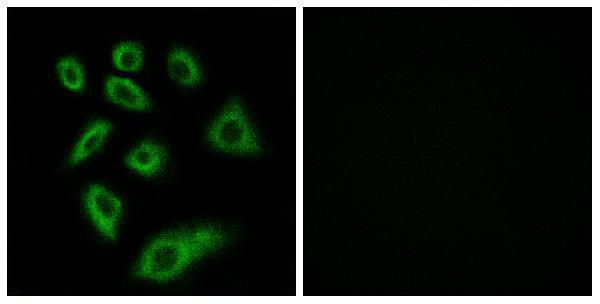 a06299 1 cyp2w1 primary antibodies if testing 1
