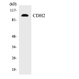 Western blot analysis of the lysates from HT-29 cells using CDH2 antibody