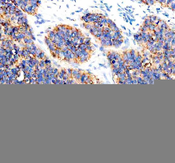  IHC analysis of CYP2W1 using anti-CYP2W1 antibody (A06299-2)