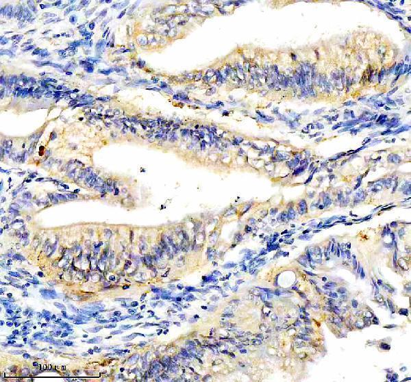 IHC analysis of CYP2W1 using anti-CYP2W1 antibody (A06299-2)