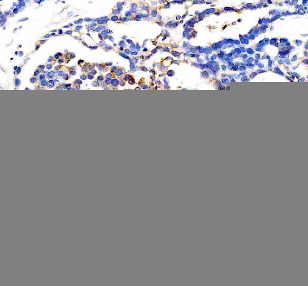 a06299 2 cyp2w1 primary antibodies ihc testing 4_1