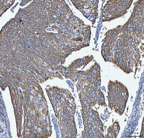  IHC analysis of S100A14 using anti-S100A14 antibody (A06301-1)