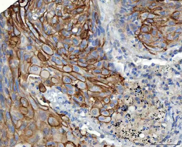  IHC analysis of S100A14 using anti-S100A14 antibody (A06301-1)