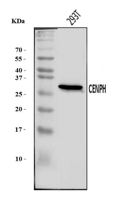  Western blot analysis of CENPH using anti-CENPH antibody (A06302-3)