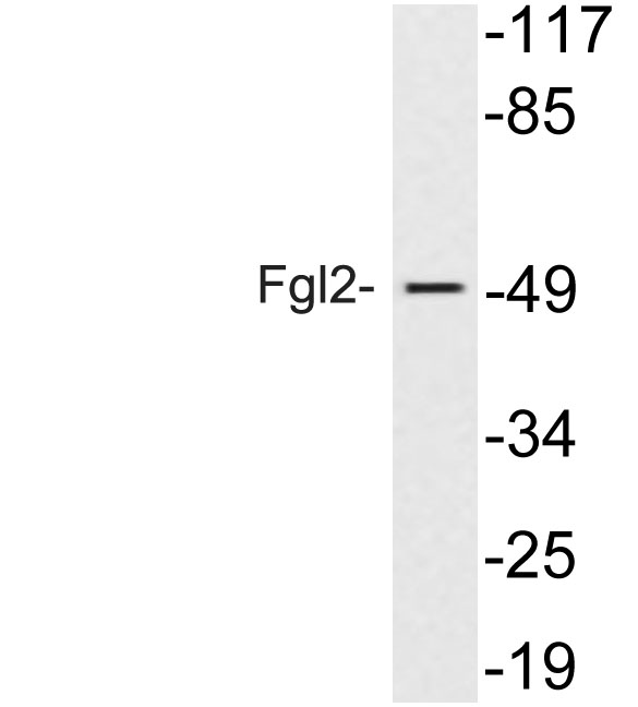 a06303 1 fgl2 primary antibodies wb testing 1