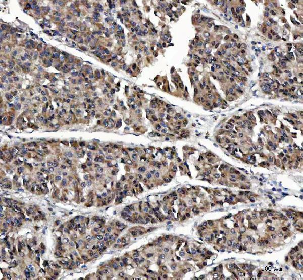 a06305 1 magel2 primary antibodies ihc testing 2