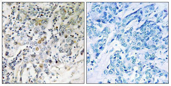 a06309 ell2 primary antibodies ihc testing 1