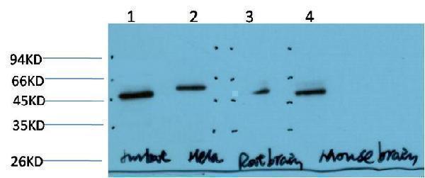 Western Blot analysis of paraffin-embedded Jurkat\Hela\Mouse-brain\Rat-brain using Gamma Tubulin Mouse mAb diluted at 1:1000