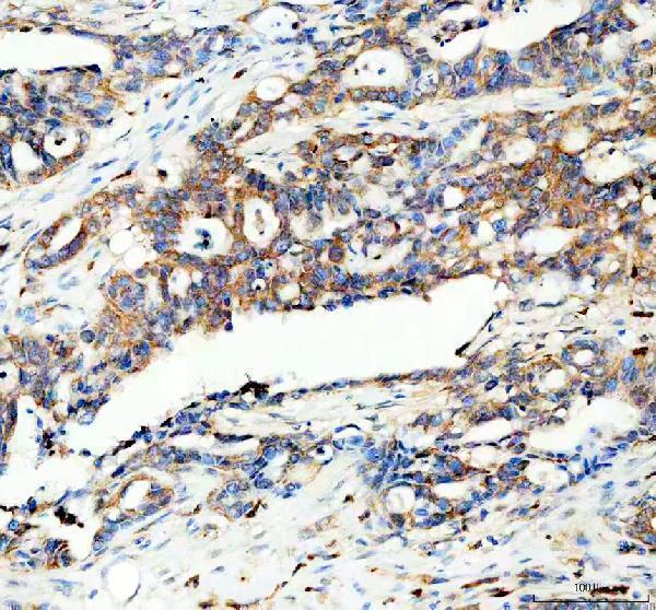  IHC analysis of PYGL using anti-PYGL antibody (A06317-1)