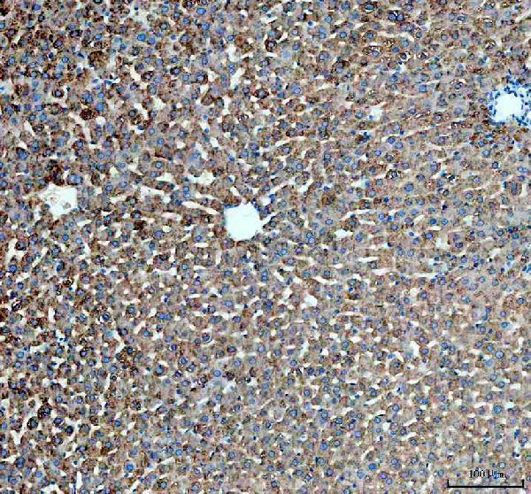  IHC analysis of PYGL using anti-PYGL antibody (A06317-1)