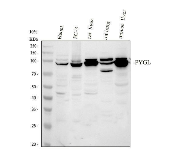  Western blot analysis of PYGL using anti-PYGL antibody (A06317-1)