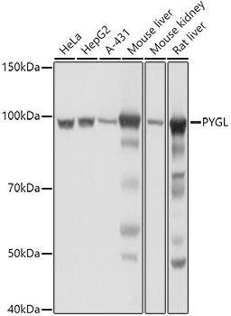 a06317 pygl primary antiboties wb testing 1