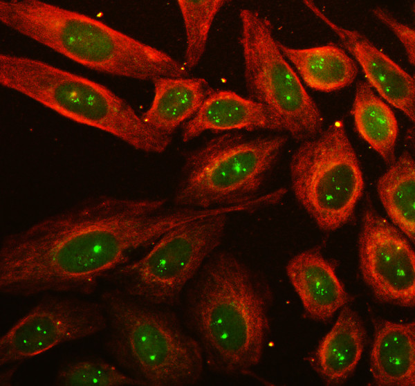 a06318 impact primary antibodies if testing 1