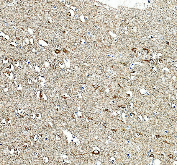 IHC analysis of IMPACT using anti-IMPACT antibody (A06318)
