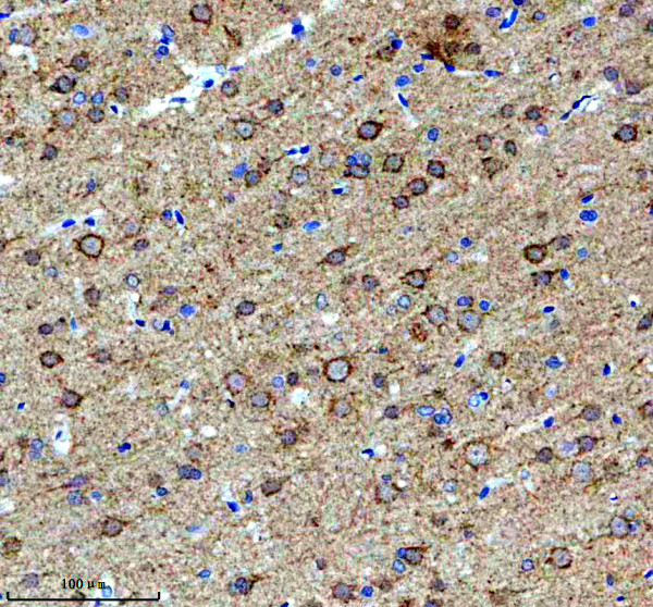 a06318 impact primary antibodies ihc testing 3