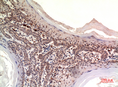 a06319 2 nov primary antibodyes ihc testing 2