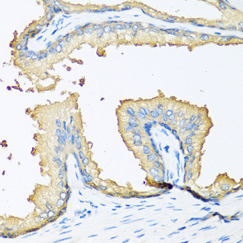 a06319 nov primary antiboties ihc testing 1