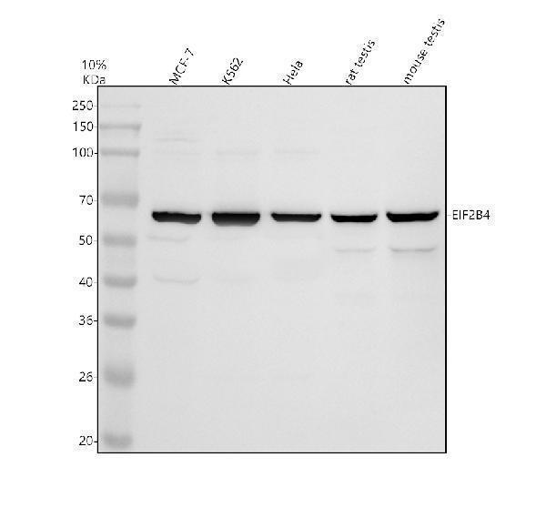 Western blot analysis of EIF2B4 using anti-EIF2B4 antibody (A06320-1)