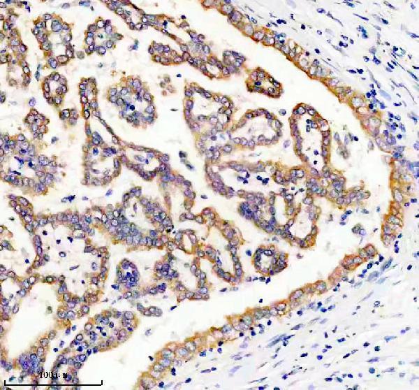 a06324 2 ube3c primary antibodies ihc testing 1