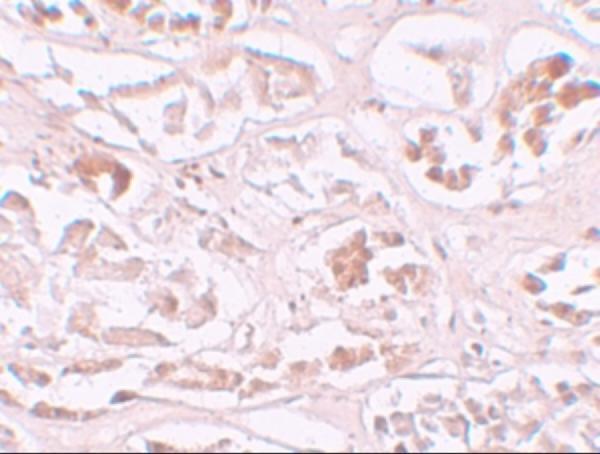 a06325 alkbh2 primary antibodies ihc testing 2