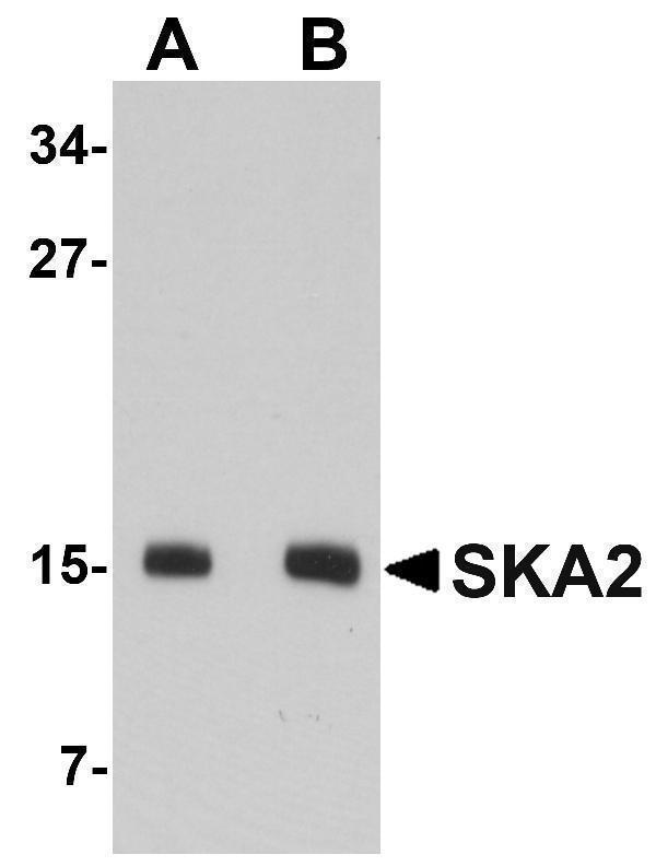 a06326 1 ska2 primary antibodies wb testing 1