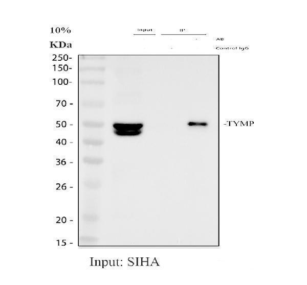 Immunoprecipitating PD-ECGF/TYMP in SiHa whole cell lysate